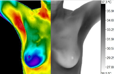Wellness Thermography Atlanta