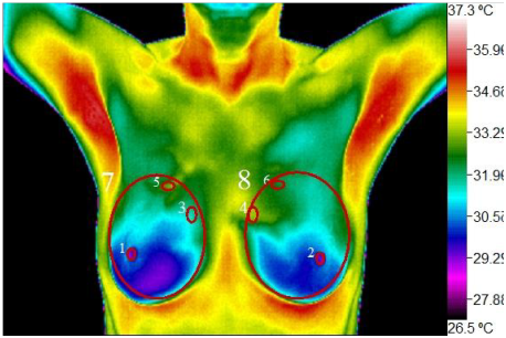 Wellness Thermography Atlanta