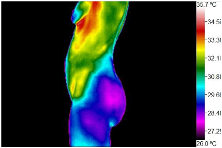 Wellness Thermography Atlanta