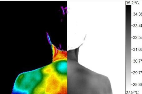 Wellness Thermography Atlanta