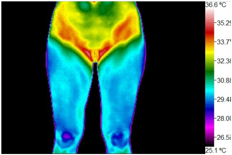 Wellness Thermography Atlanta