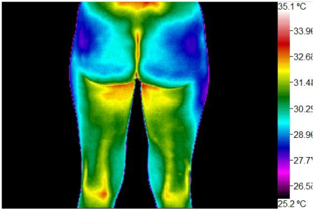 Willness Thermography Atlanta