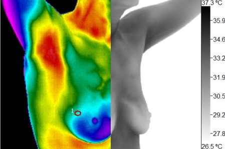 Wellness Thermography Atlanta