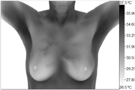 Wellness Thermography Atlanta