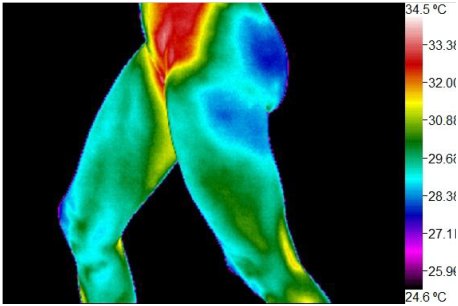 Willness Thermography Atlanta