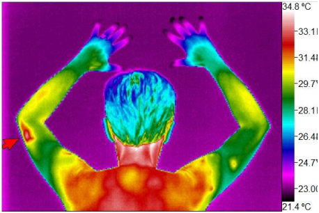 Willness Thermography Atlanta