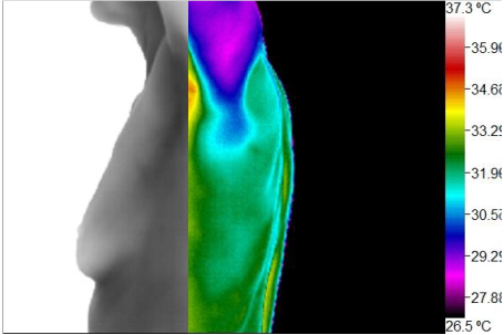 Wellness Thermography Atlanta