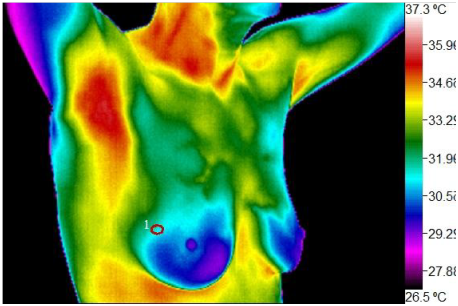 Wellness Thermography Atlanta