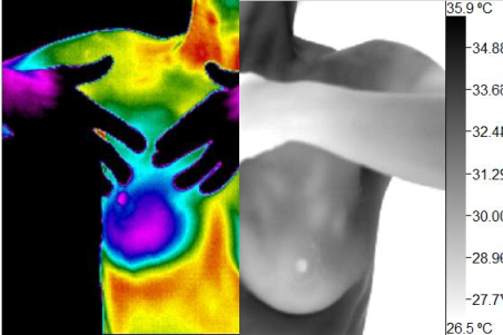 Willness Thermography Atlanta