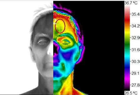 Wellness Thermography Atlanta