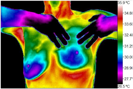 Wellness Thermography Atlanta