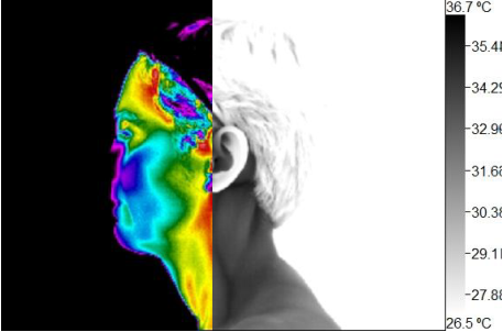 Willness Thermography Atlanta