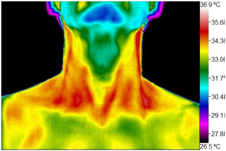 Wellness Thermography Atlanta