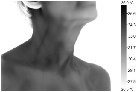 Wellness Thermography Atlanta
