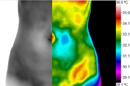 Wellness Thermography Atlanta