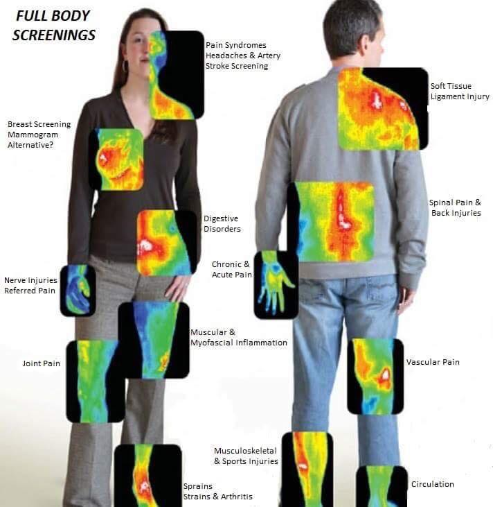 Full Body Thermography