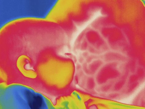 Kids Wellness Thermography Atlanta